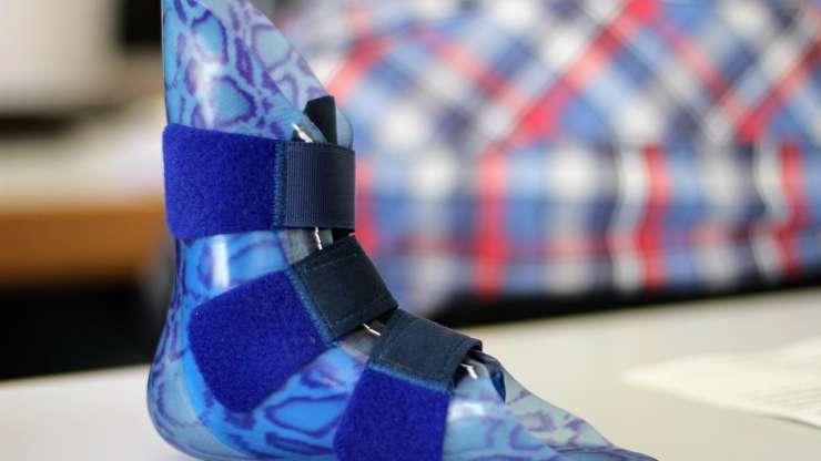 5 Tips For a Comfortable Prosthesis